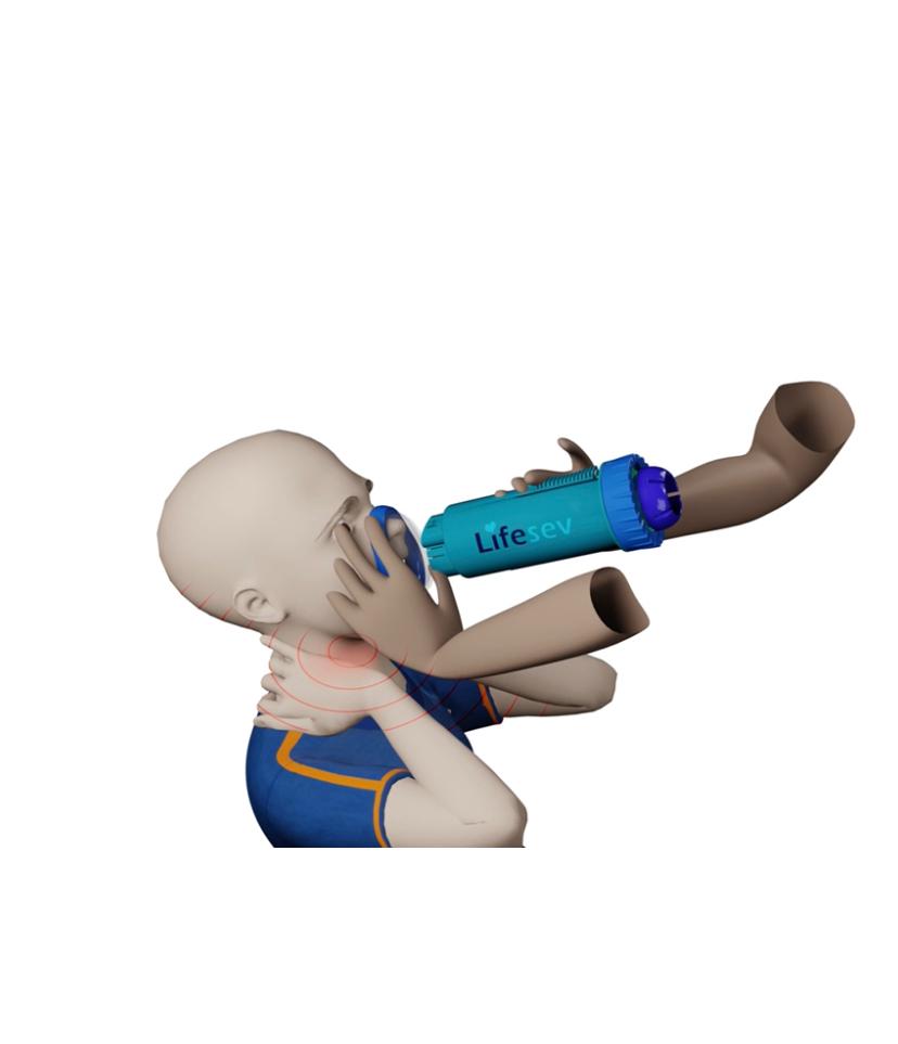 LIFESEV™ ANTI CHOKING DEVICE THAT SAVES LIVES! 7 LIFESEV™ ANTI CHOKING DEVICE THAT SAVES LIVES! 1