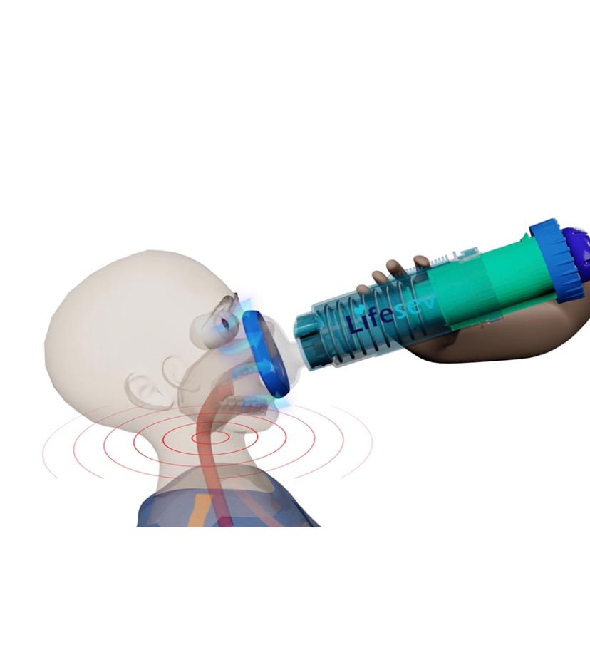 LIFESEV™ ANTI CHOKING DEVICE THAT SAVES LIVES! 8 LIFESEV™ ANTI CHOKING DEVICE THAT SAVES LIVES! 2